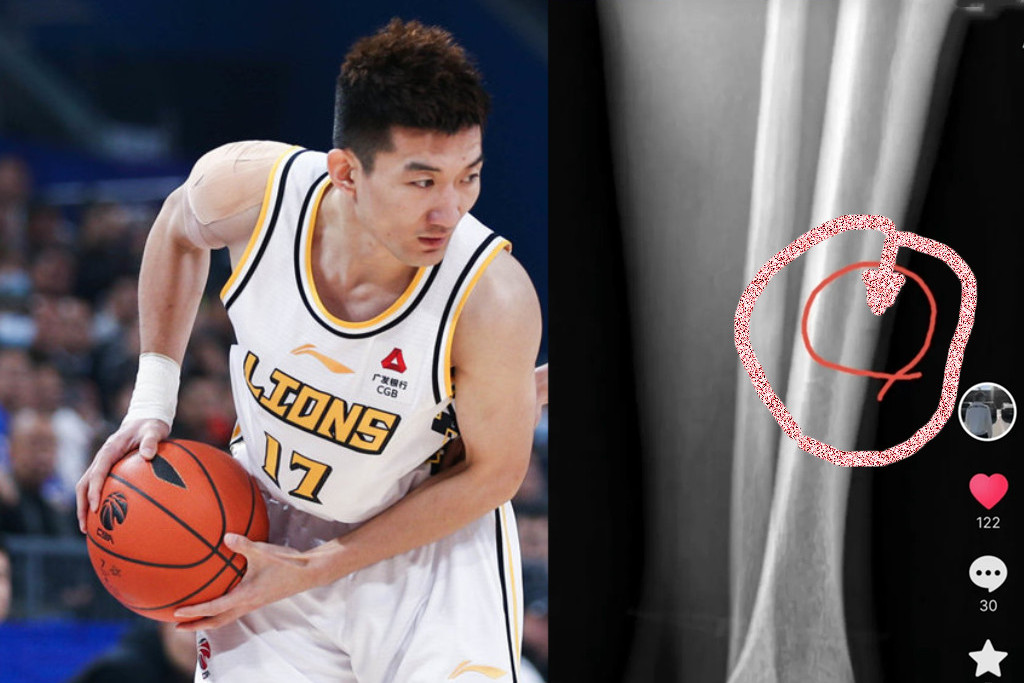 开云注册-太狠了！金州勇士围绕CBA季后赛再遭质疑转会期勒沃库森备战意大利杯，今夜广厦男篮调整名单以备NBA季后赛的简单介绍